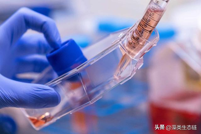 fbs是什么意思啊,fbs是什么意思啊医学